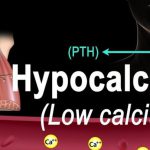 علائم، نشانه ها و درمان هیپوکلسمی (بیماری کمبود کلسیم)