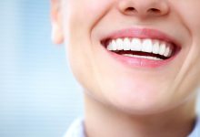 عکس لمینت دندان