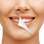 طول عمر لمینت دندان
