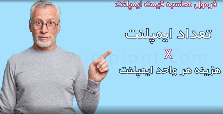 قیمت ایمپلنت دندان در ایران