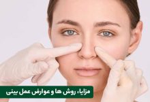 مزایا عمل بینی