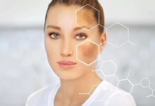 کرم ضد لک و روشن کننده