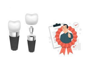 گارانتی ایمپلنت دندان