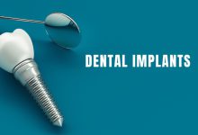 ایمپلنت دندان در سعادت آباد