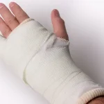 شکستگی دست و درمان آن