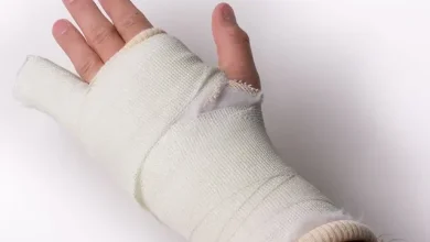 شکستگی دست و درمان آن