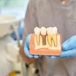 مرکز ایمپلنت خوب تهران