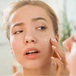 پوست خشک و بهترین روش های مراقبت از آن