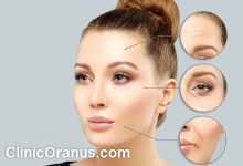 بهترین مرکز تزریق بوتاکس در تهران کلینیک اورانوس